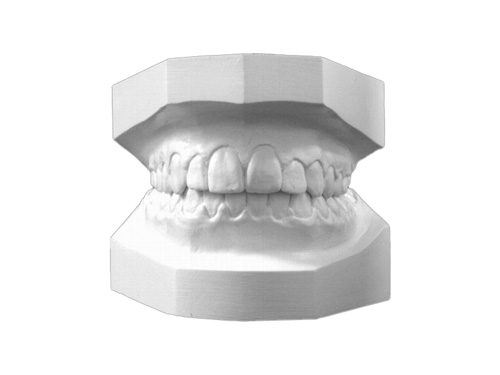 Ortodoncja Dabala Katowice Śląsk - leczenie ortodontyczne
