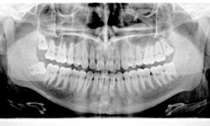 Ortodoncja Dabala Katowice Śląsk - leczenie ortodontyczne